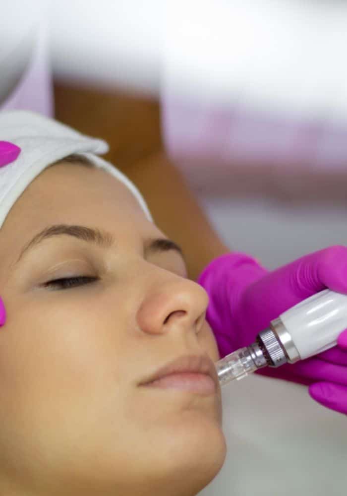 Curso Profesional en Microneedling
