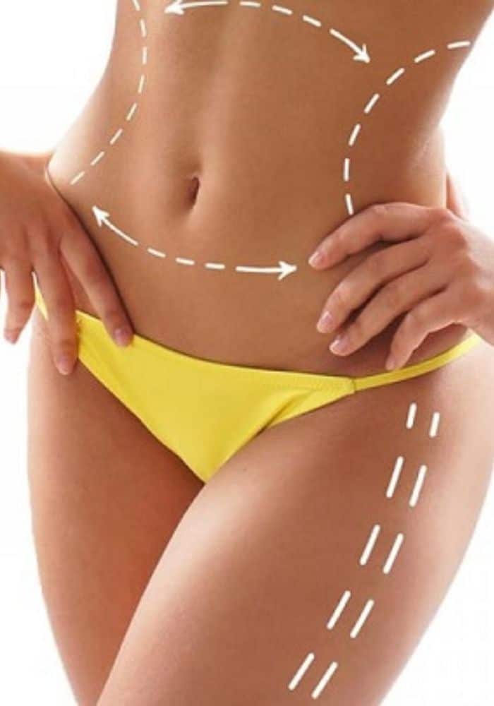 DRENAJE LINFÁTICO BRASILEÑO